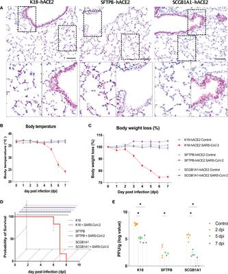 Mouse models of lung-specific SARS-CoV-2 infection with moderate pathological traits